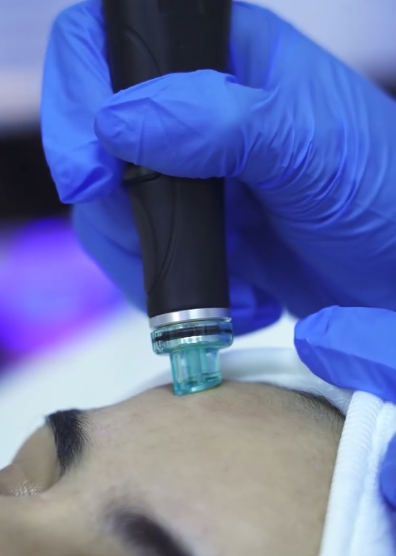 Traitement de l'acné et cicatrices à Tanger